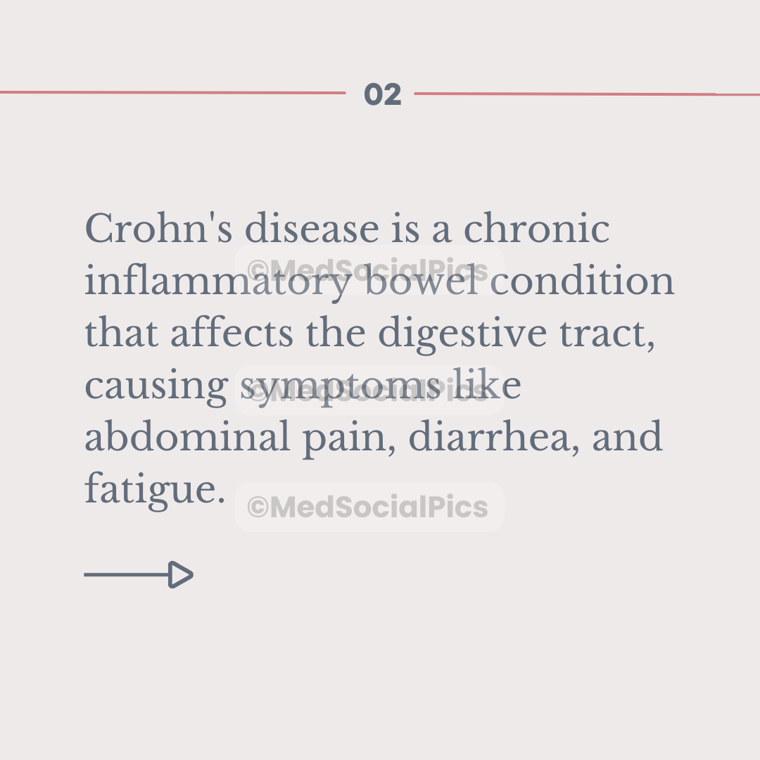 Crohn's Disease