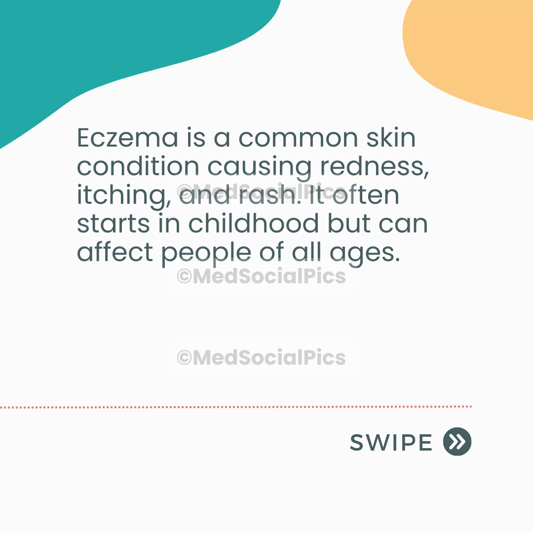 Eczema