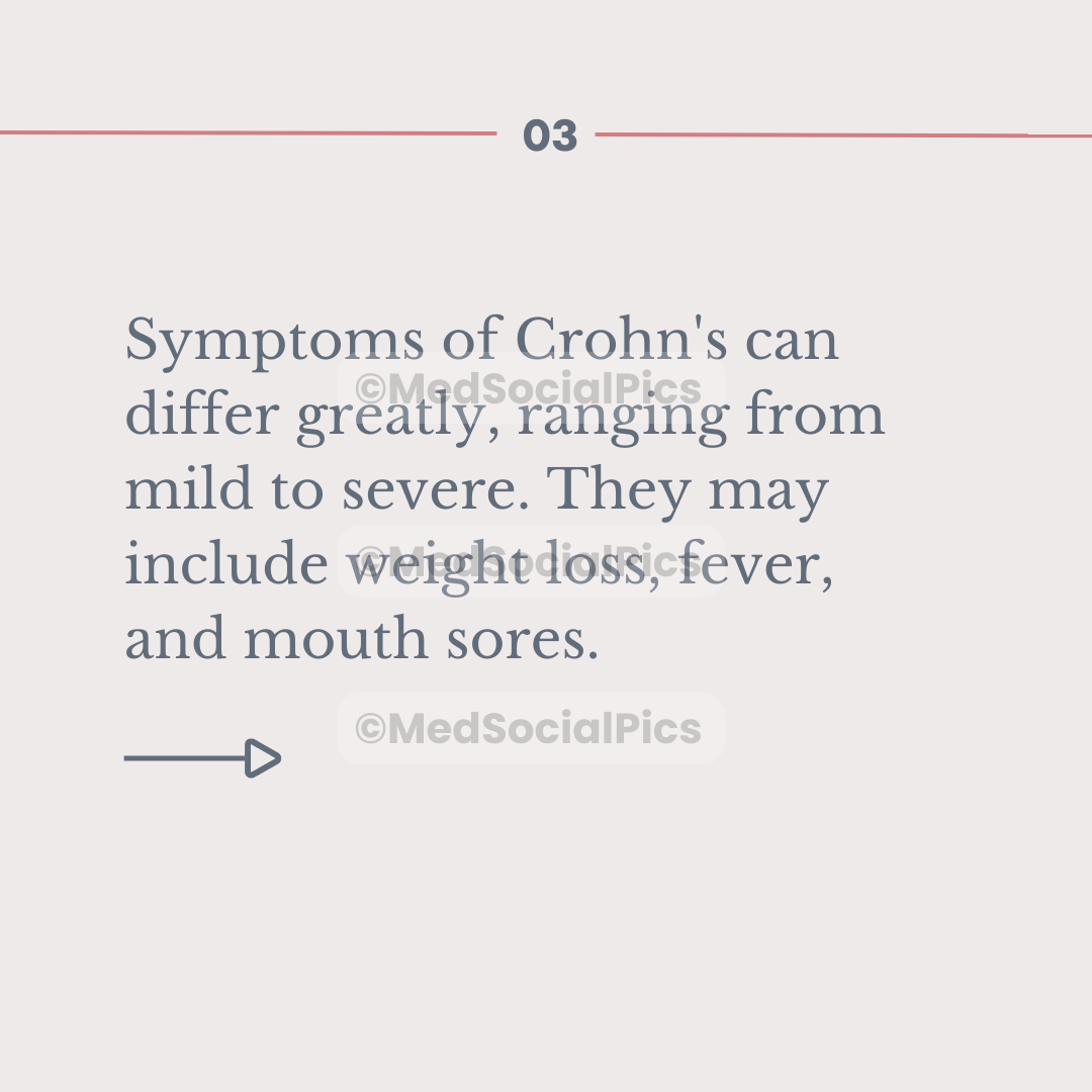 Crohn's Disease