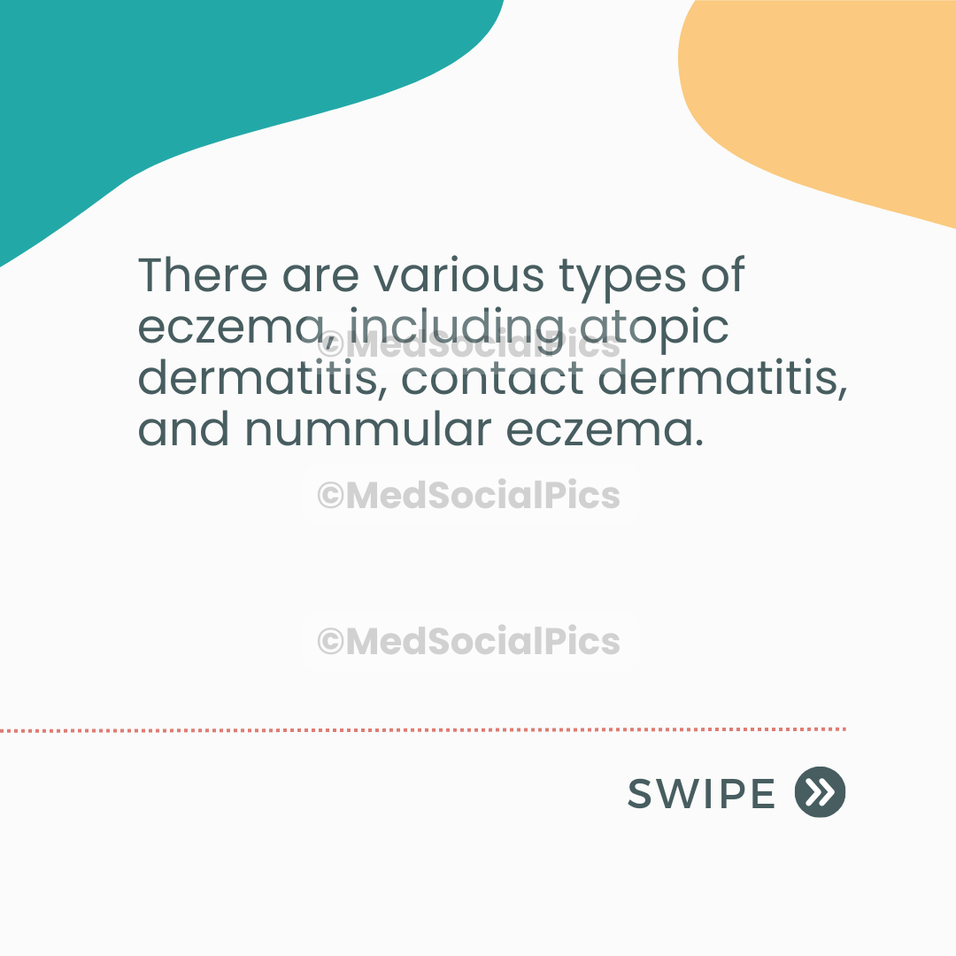Eczema