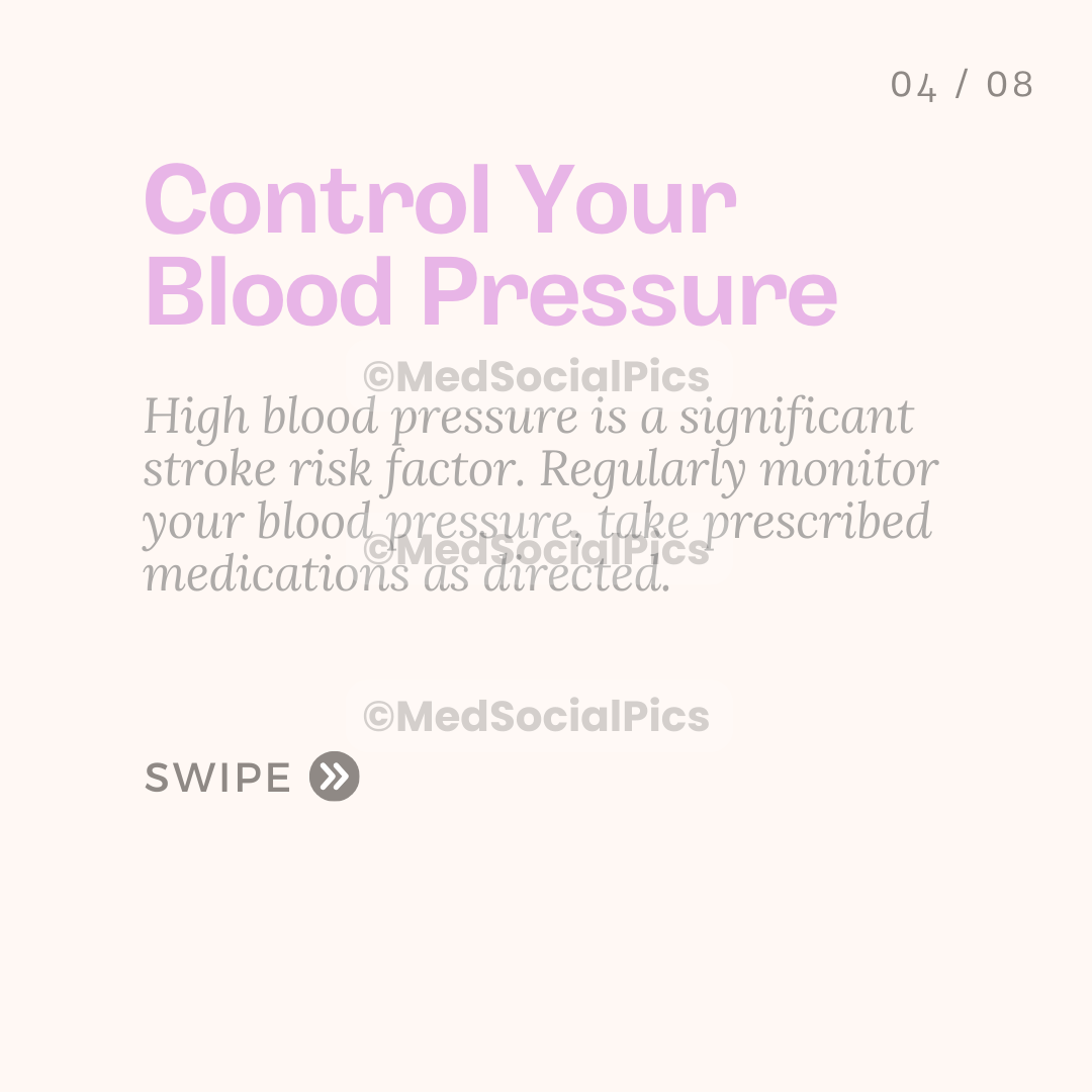 How to Prevent Stroke