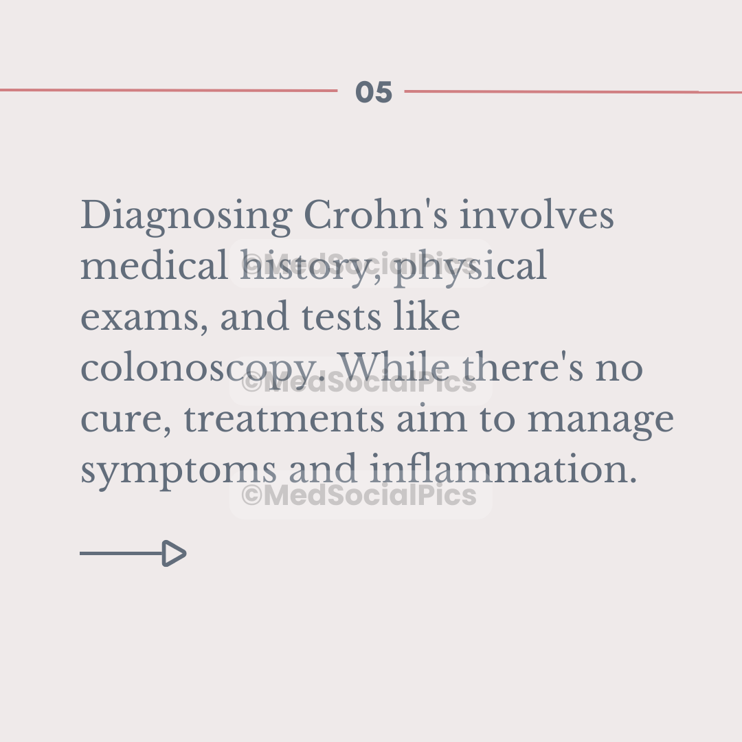 Crohn's Disease