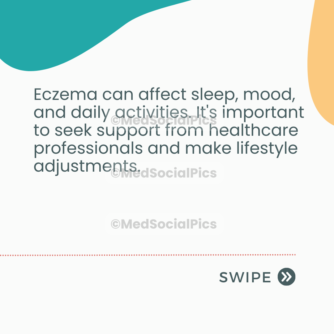 Eczema