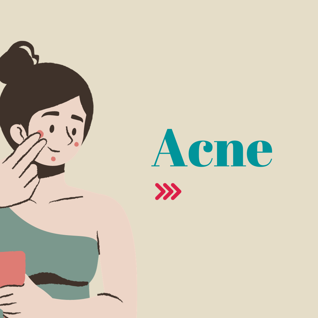 Acne