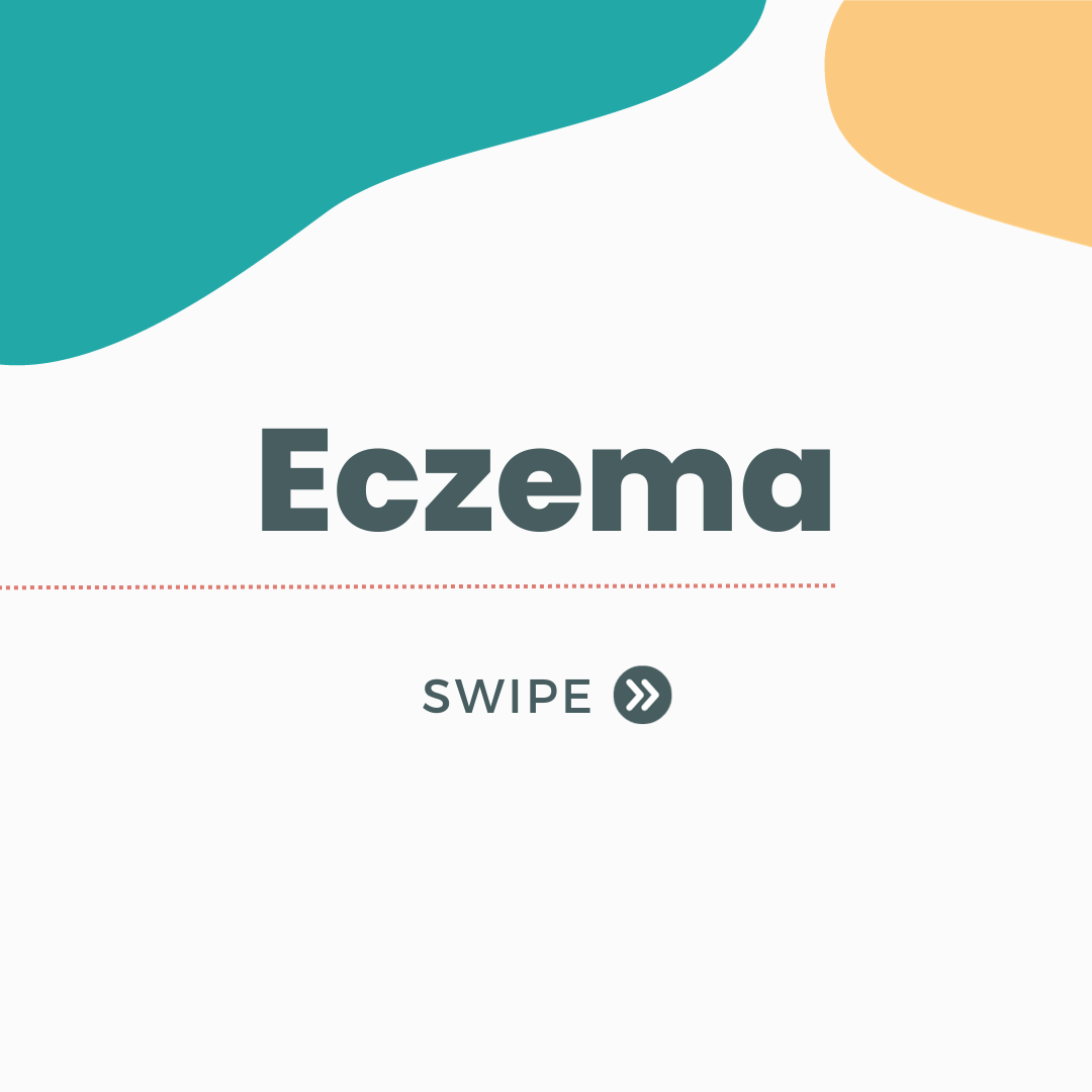 Eczema