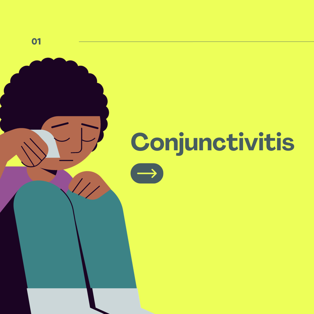 Conjunctivitis