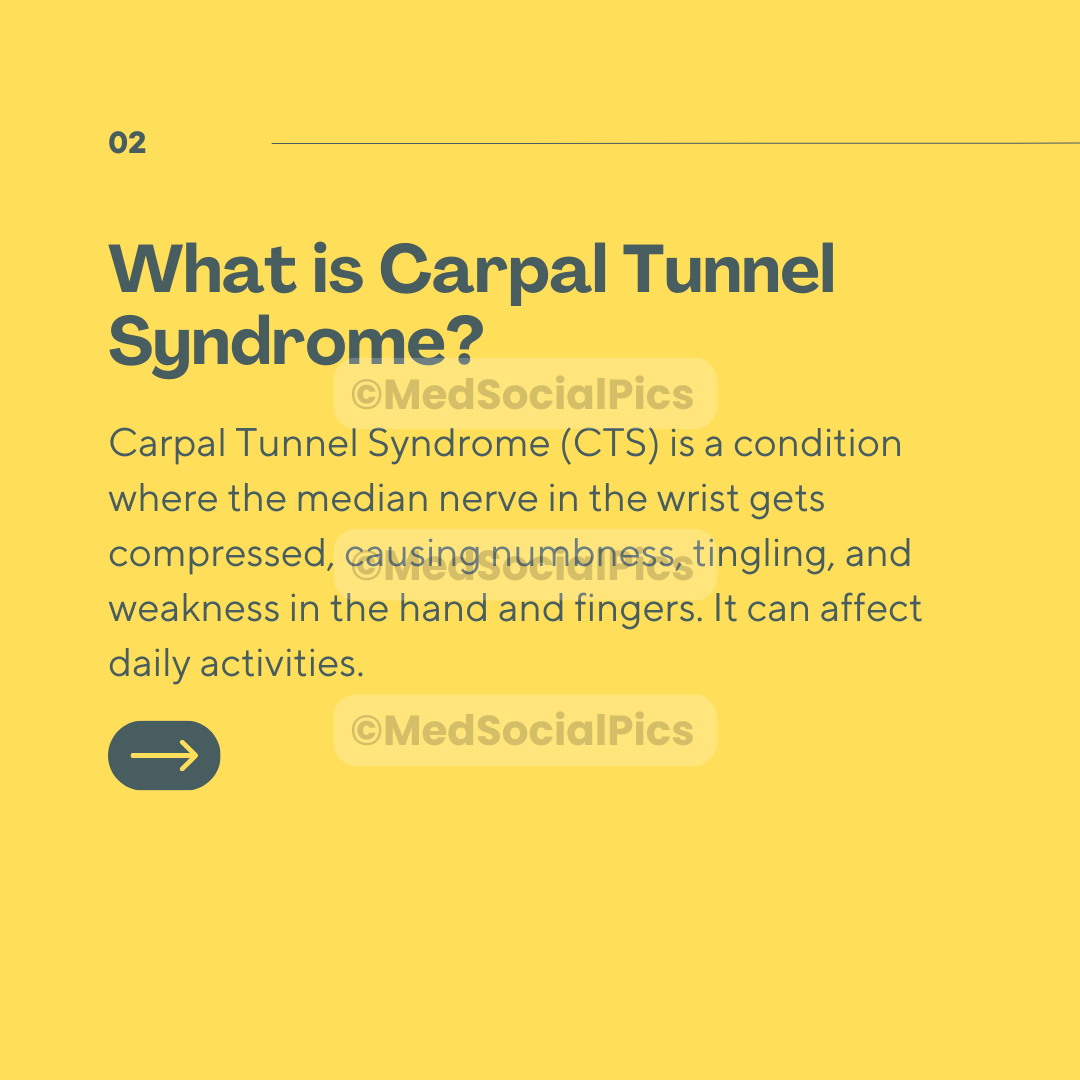 Carpal Tunnel Syndrome