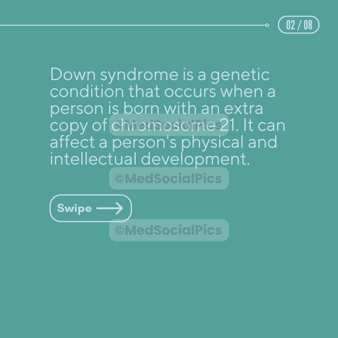 Down Syndrome