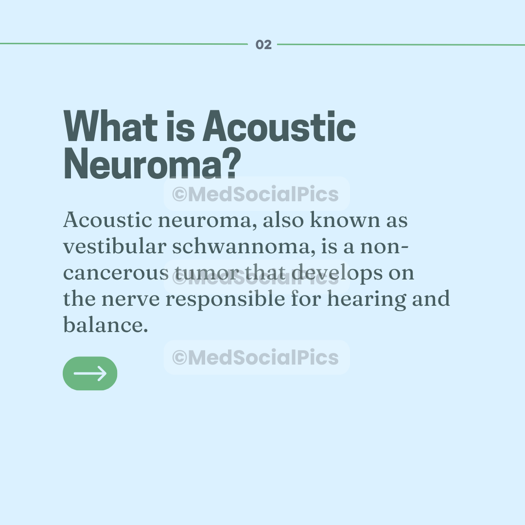 Acoustic Neuroma