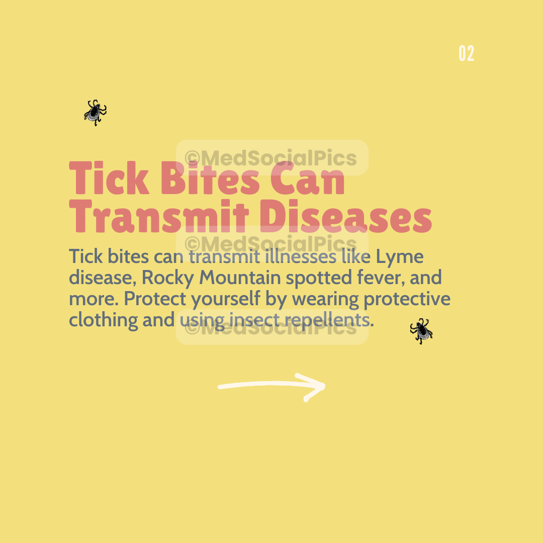 Tick Bites