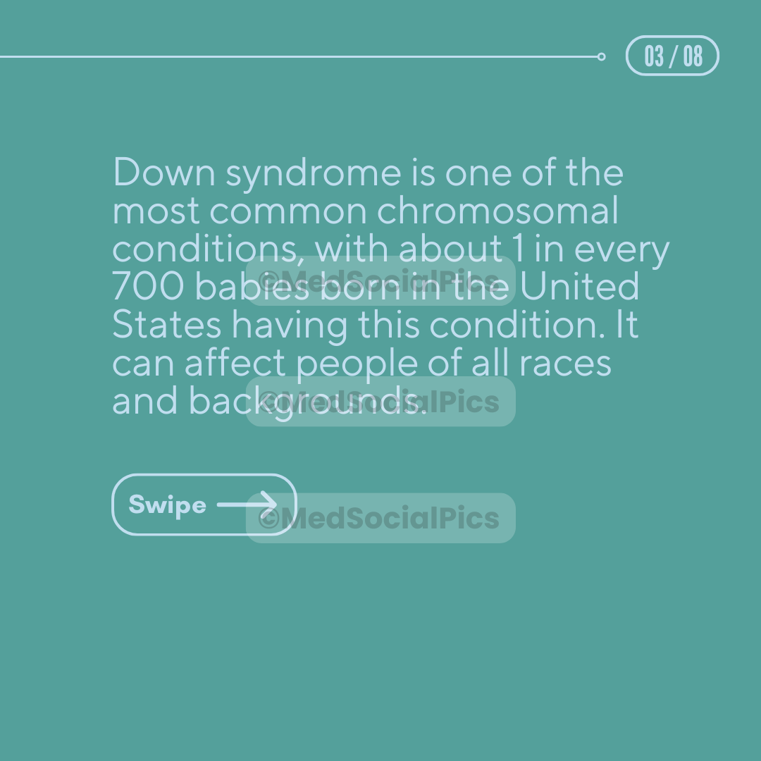 Down Syndrome