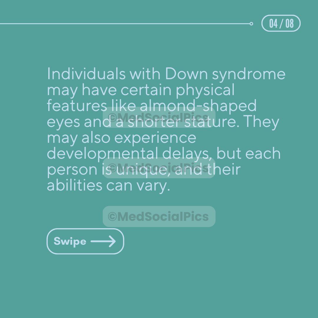 Down Syndrome