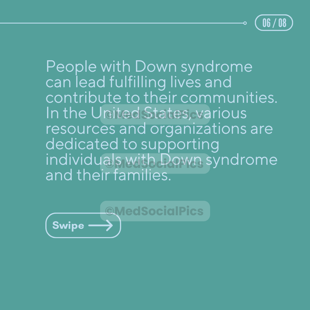 Down Syndrome