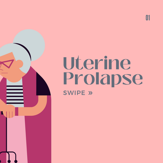 Uterine Prolapse