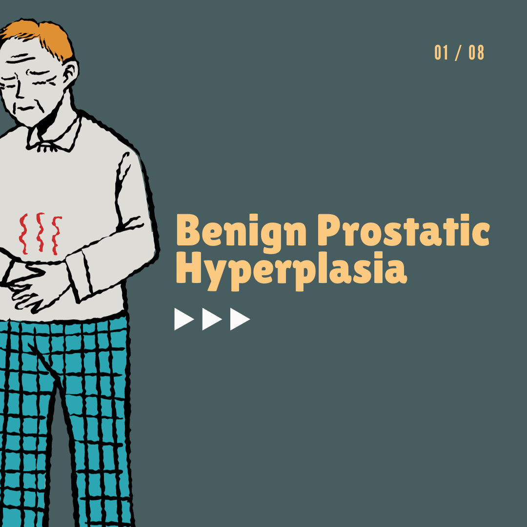 Benign Prostatic Hyperplasia