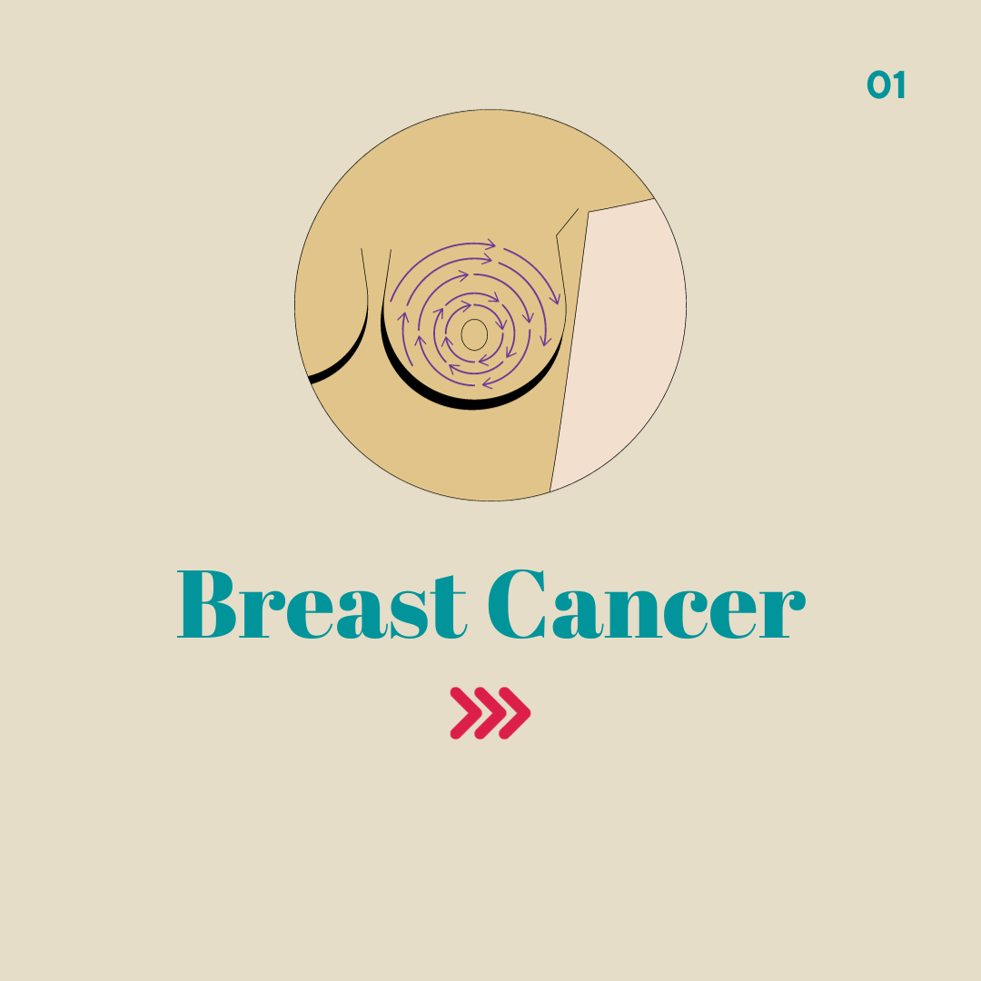 Breast Cancer